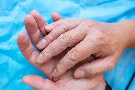 ¿Qué reconoce la Resolución de la OMS?